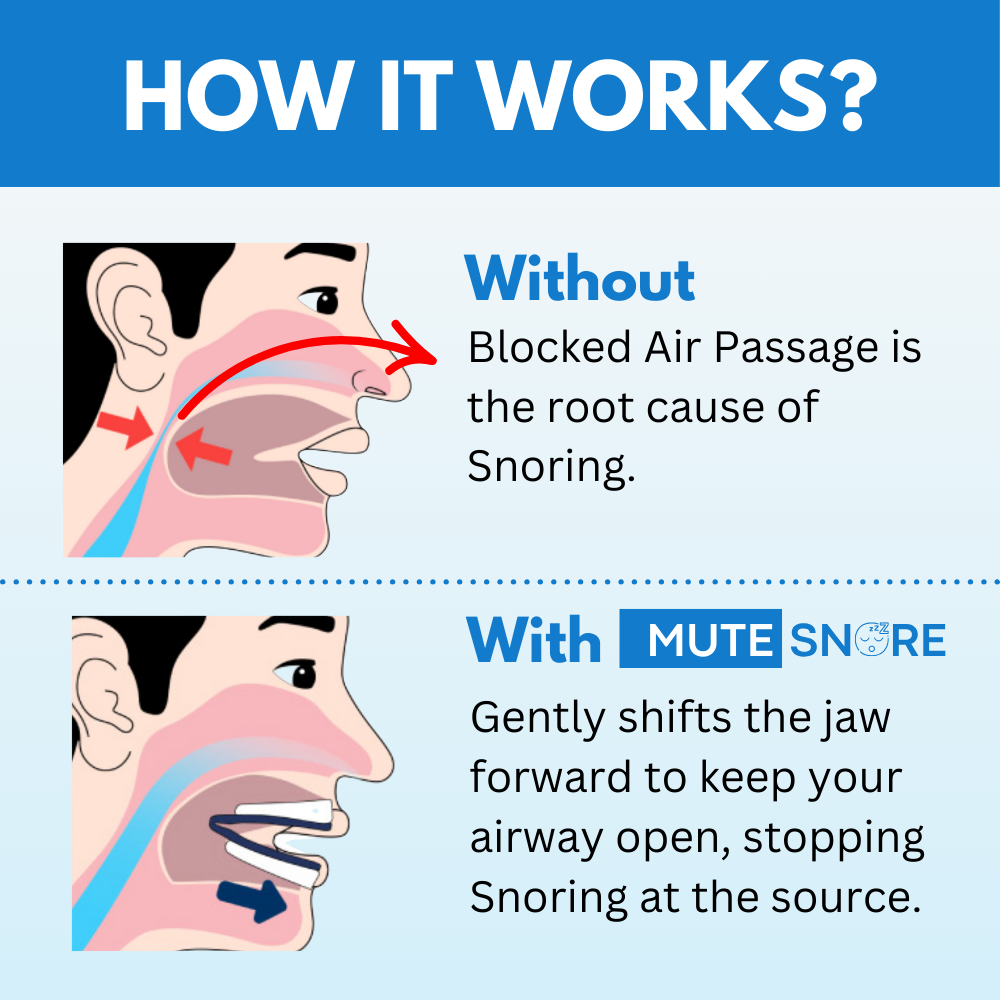 Oralpure Anti-Snoring Mouthpiece – Stop Snoring & Sleep Better